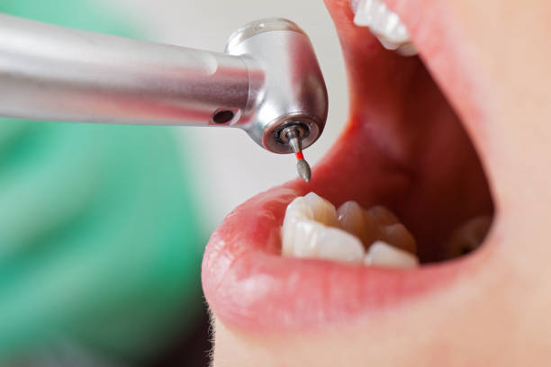 Best Weekend Emergency Dental Services in Forest Hills, MI